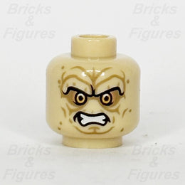 epi