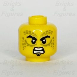 epi