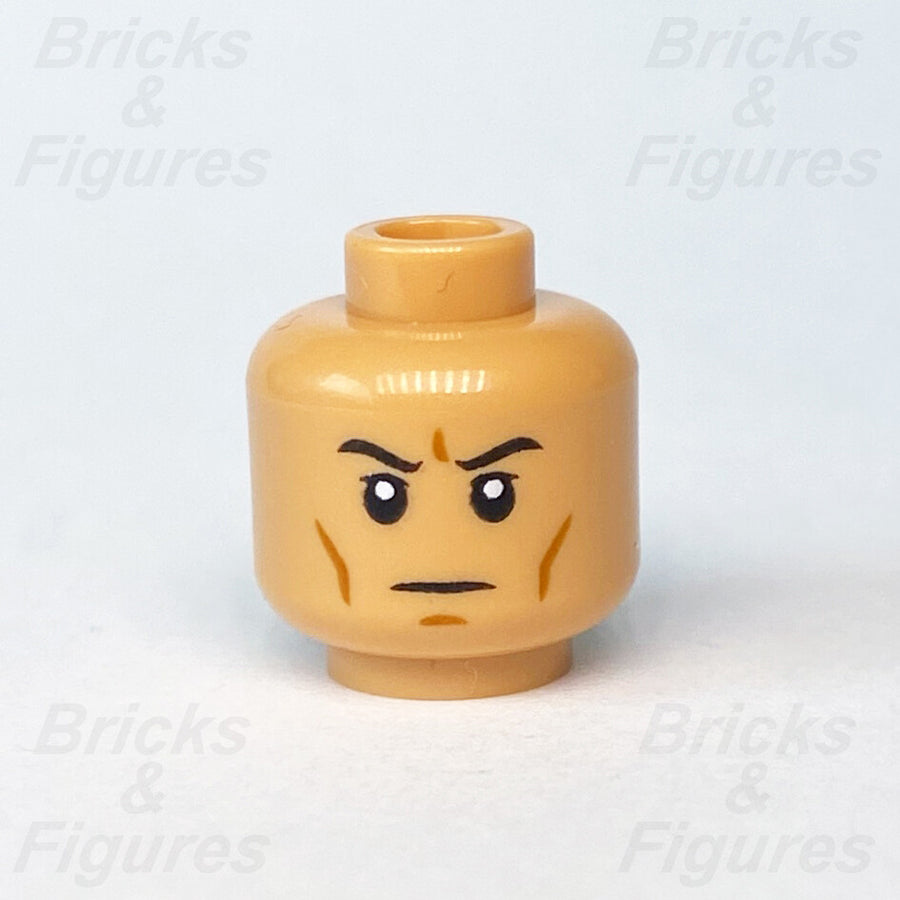 epi